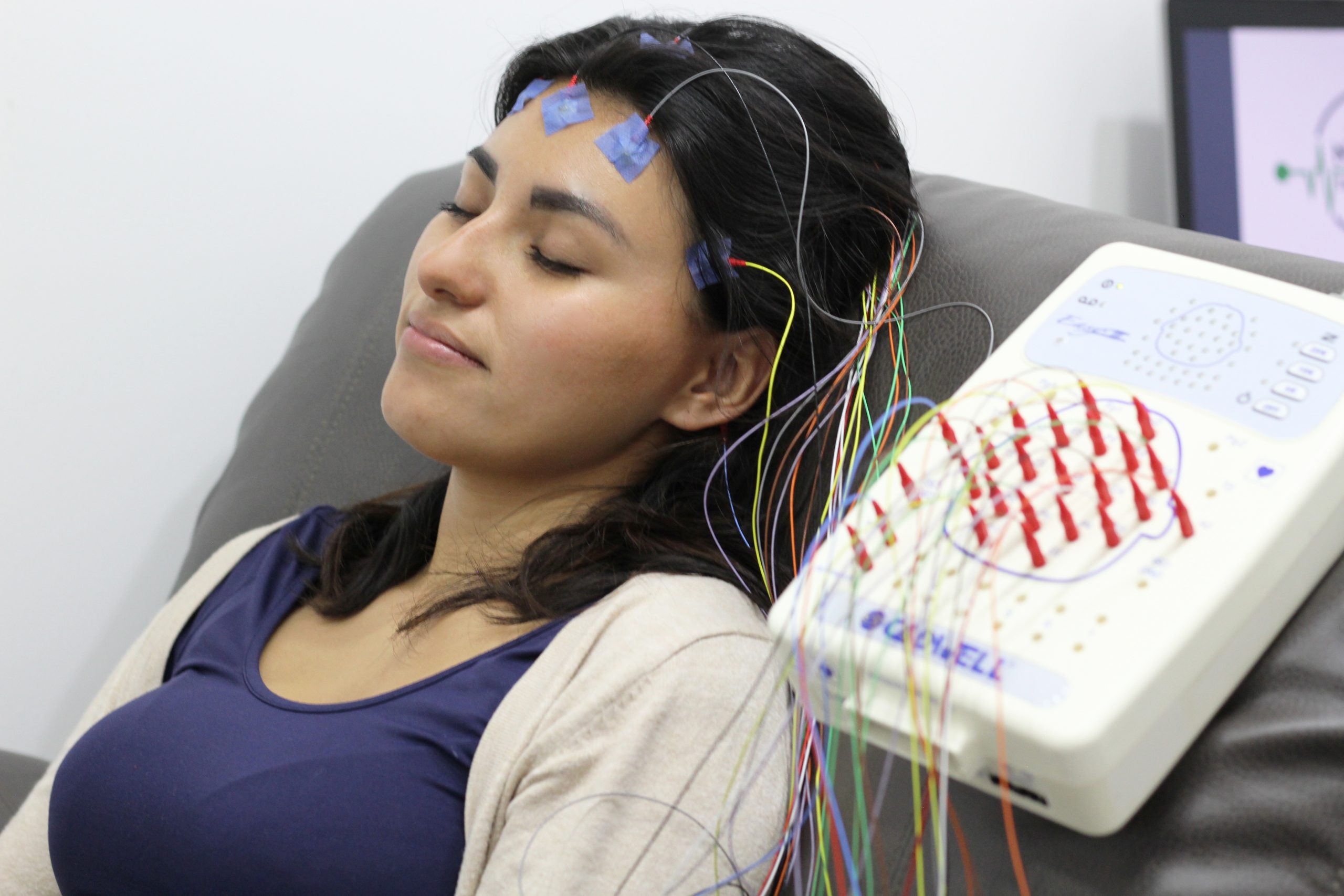 Electroencefalograma estudio médico para el cerebro