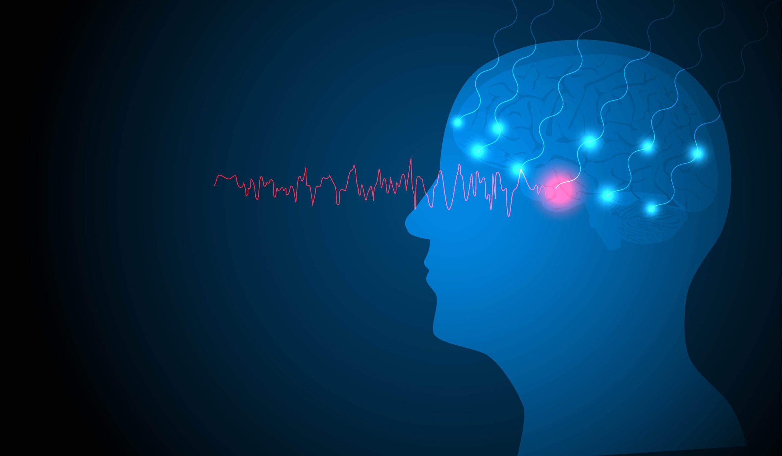 Temporal Lobe Epilepsy and the Role of Subtemporal Electrodes - ASET ...